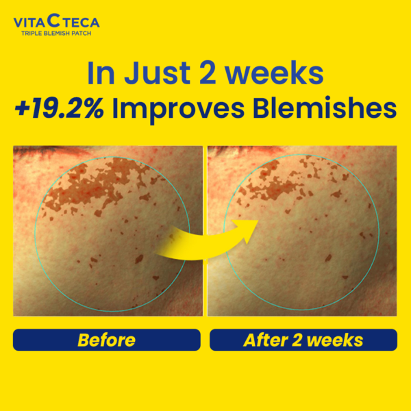 Vita C Teca Triple Blemish